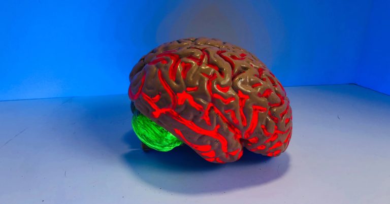 Practical Tips to build a Dementia-Resistant Brain